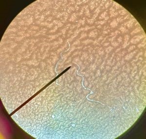 Microfilaria (baby heartworms) in a blood sample from a heartworm positive patient.